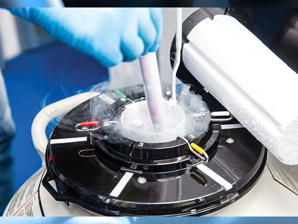 ये भी करवा सकते है स्‍पर्म फ्रीजिंग