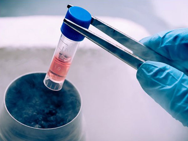 स्‍पर्म फ्रीज करने का स्‍टेप बाई स्‍टेप प्रोसेस