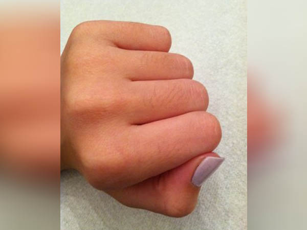  हल्दी और कच्चा दूध से हटाएं उंगलियों के बाल