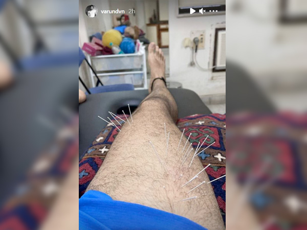 क्‍या है नीडल थेरेपी?