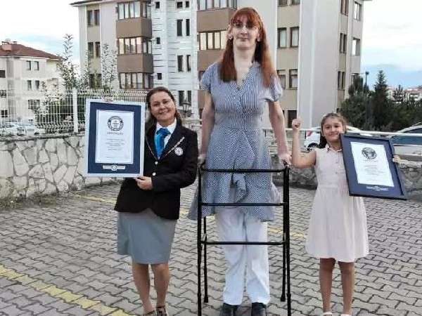 बीमारी के कारण बढ़ी हाइट बीमारी के कारण बढ़ी हाइट