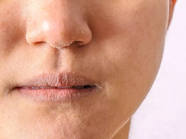 ड्राई स्किन के लिए कोल्ड क्रीम