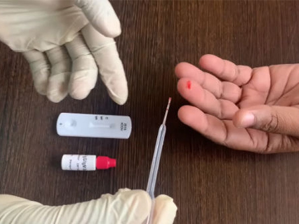 एट-होम कोरोना टेस्ट के रिजल्ट कितने सटीक होते हैं?