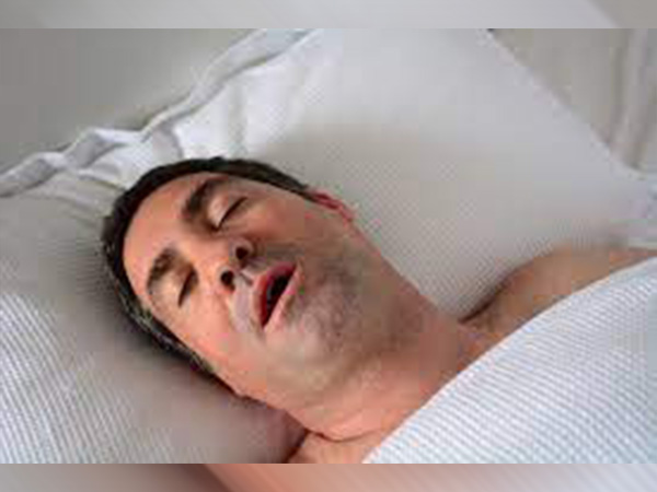 क्या होता है ऑब्सट्रक्टिव स्लीप एपनिया क्या होता है ऑब्सट्रक्टिव स्लीप एपनिया