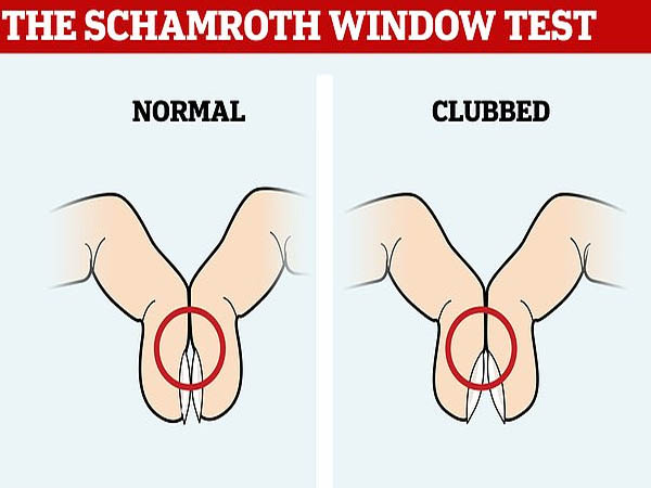 ये है जांच करने का तरीका