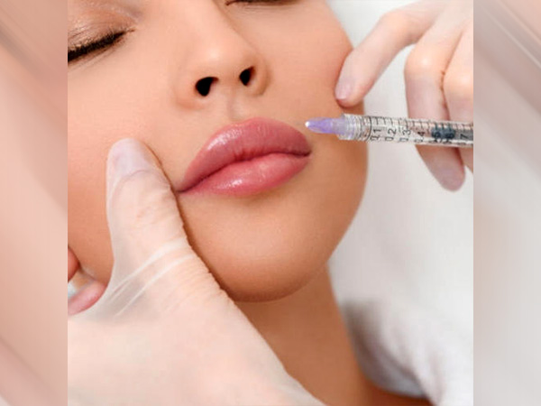 बोटॉक्स की तरह ही फिलर्स के भी अपने दुष्प्रभाव हैं। जैसे-