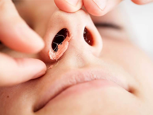 नाक के बाल हटाने से स्वास्थ्य पर क्या प्रभाव पड़ता है?