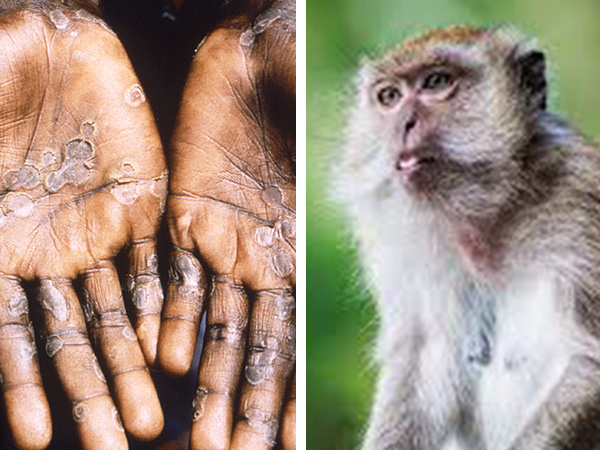 WHO ने हेल्थ इमरजेंसी की घोषित