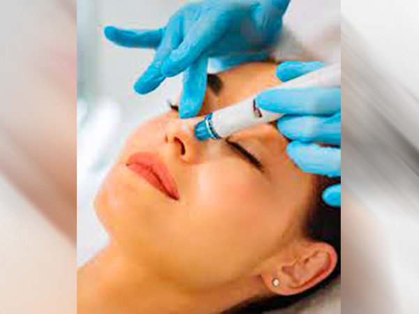 कैसे होता है हाइड्रा फेशियल ?