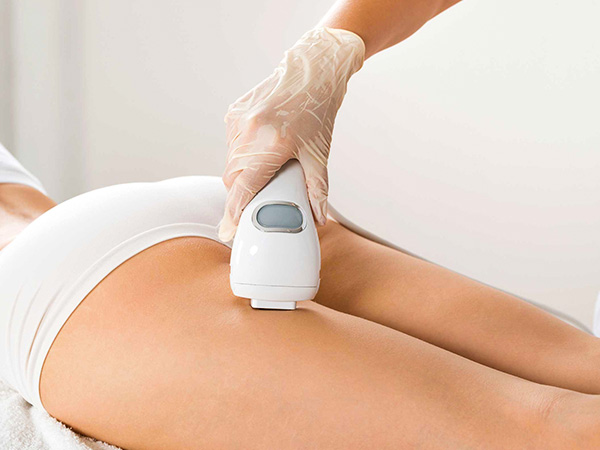 पर्पल स्ट्रेच मार्क्स का इलाज कैसे करें?