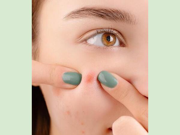 त्वचा कोशिकाओं का कार्सिनोमा कैंसर त्वचा कोशिकाओं का कार्सिनोमा कैंसर