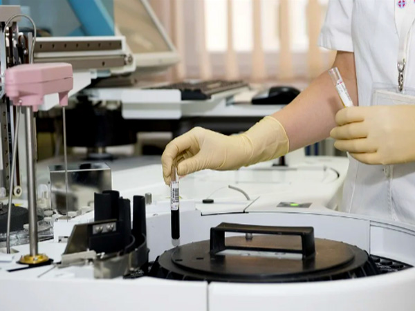 कम कोलेस्ट्रॉल के संकेत