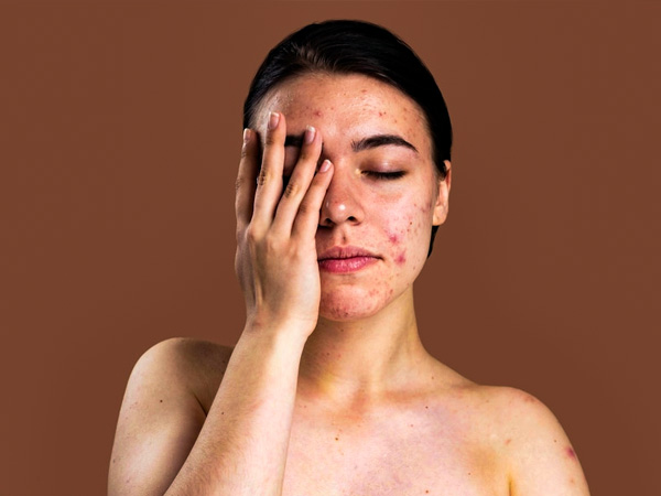 know about pale people problems in hindi