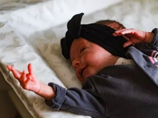 रैशेज का बढ़ जाता है रिस्क