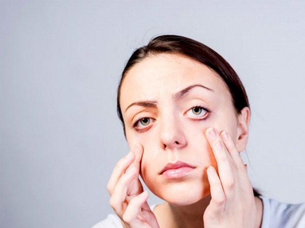 रोने से सूजी आंखों से कैसे छुटकारा पाएं