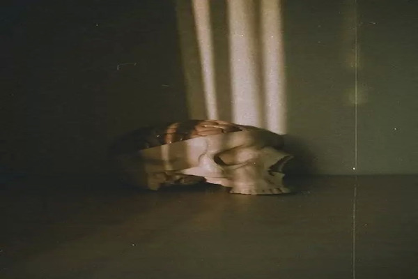 नेगलेरिया फाउलेरी के संक्रमण होने के लक्षण क्या है ?