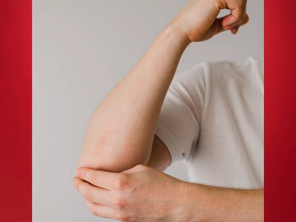 4. घुटनों और कोहनी के कालेपन को करें दूर