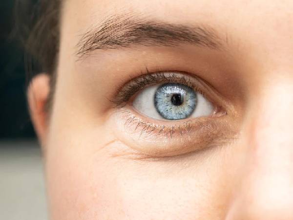 4. स्किन की सूजन को कम करने में मददगार