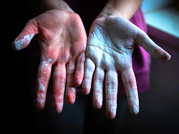 हाथ क्यों हो जाते हैं रफ और खुरदरें