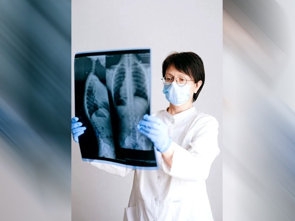 आम फ्लू भी निमोनिया के होने का कारण