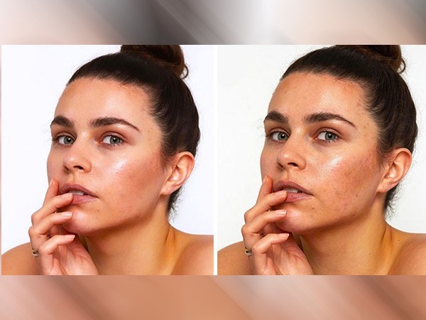 Matrimonial Sites Security Tips: फिल्टर वाली फोटो ना लगाएं