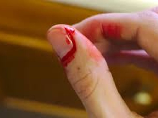 How To Care For A Child With Hemophilia