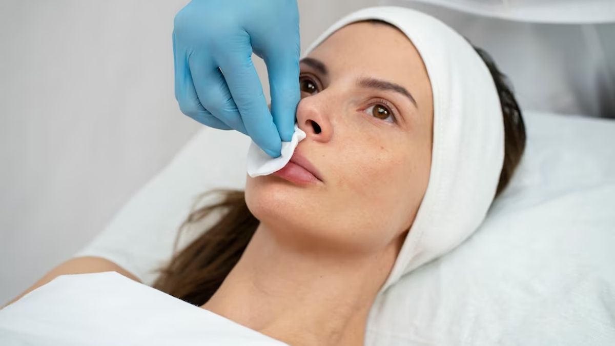 Upper Lip Hair Removal Upper Lip Hair Removal