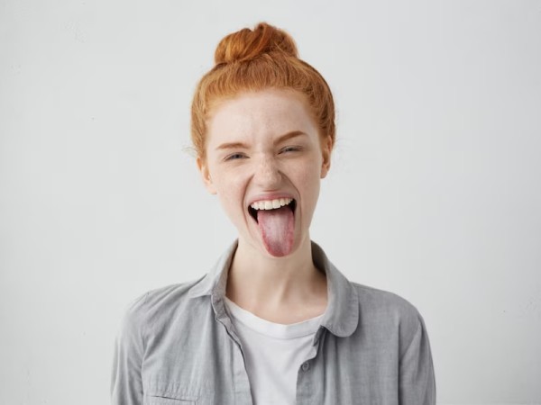 White Tongue
