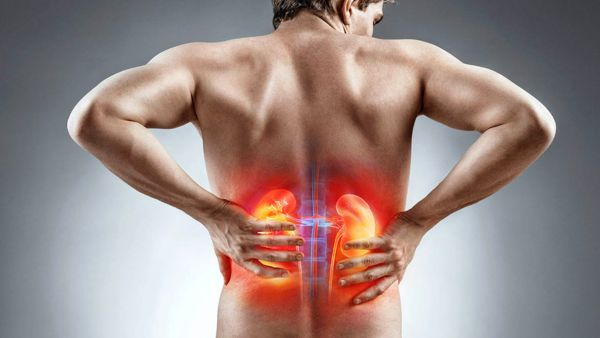 Tomatoes Cause Kidney Stones 