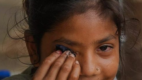 Eye Flu Repeat Cases