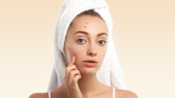 Side Effects Of Pimple Popping With Towel in hindi