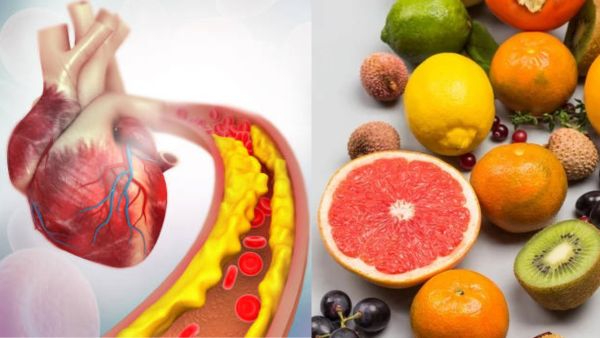 5 Fruits To Help Lower Cholesterol To Add To Your Diet