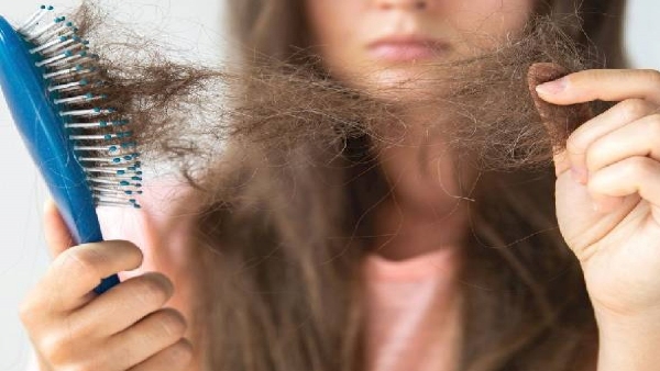 HAIR FALL AFTER DELEVARY HAIR FALL AFTER DELEVARY