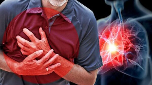 Heart Attack First Aid