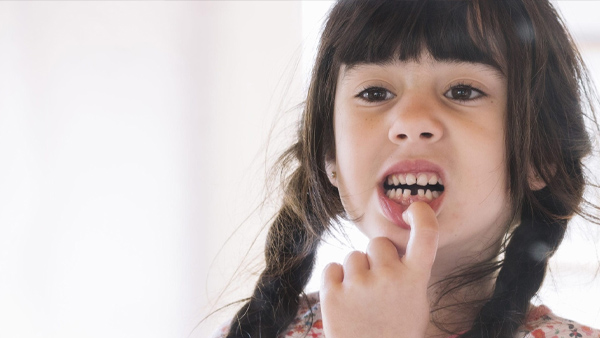 teeth, kids, oral health