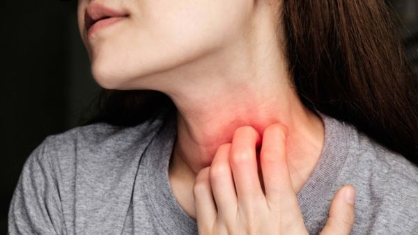  Priyanka Chopra’s mother Madhu Chopra Suffreing From Anaphylaxis