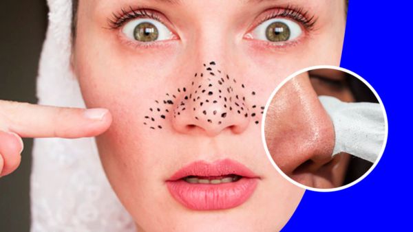 Easy Ways To Make Pore Strip At Home in hindi	