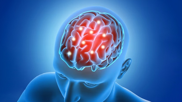 man suffered 100 mini strokes: how many mini strokes can a person have and survive know its signs symptoms