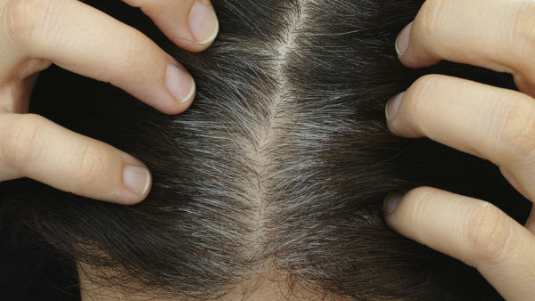 Home Remedies To Treat Premature Greying In Kids