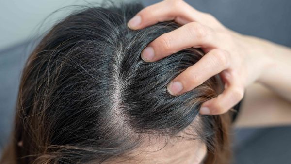 Reasons Of Itchy Scalp During Pregnancy in hindi	