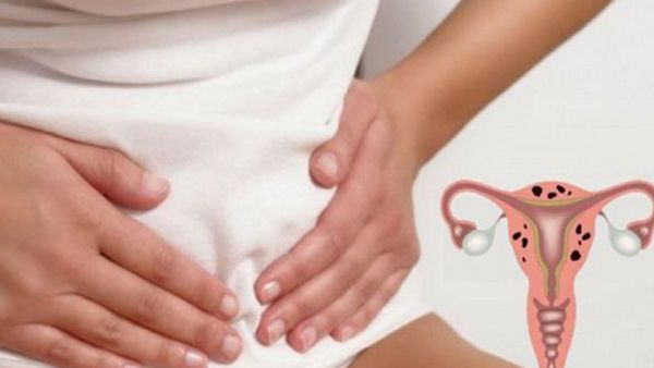 What is Bulky Uterus and How to reduce Naturally