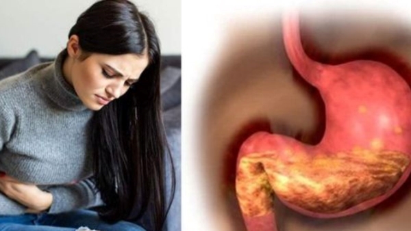 Why Gas Problem Increase in Winters in Hindi