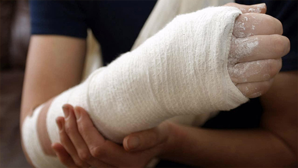 5 Mistakes to Avoid after a Fracture: 