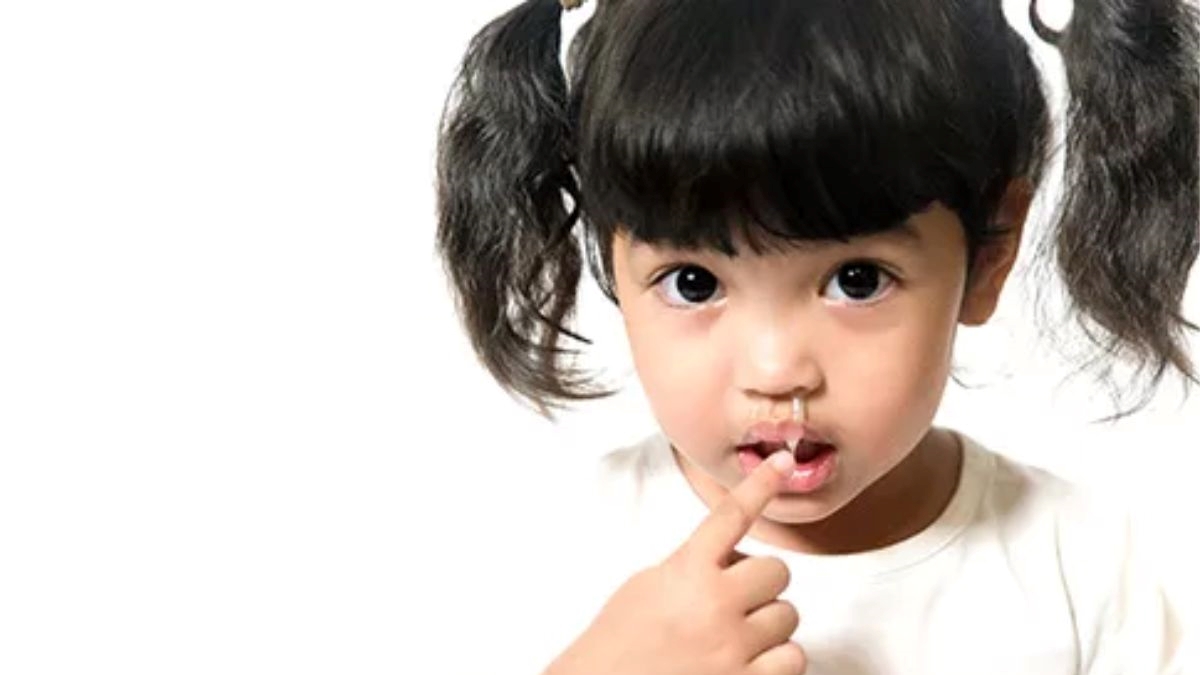 Measles symptoms appear 7 to 14 days after contact with the virus and