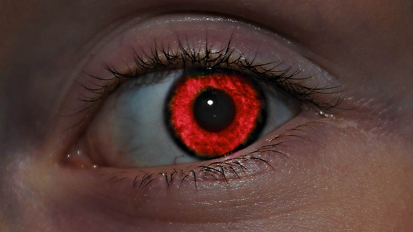 Red-Eye Effect in Photos Red-Eye Effect in Photos