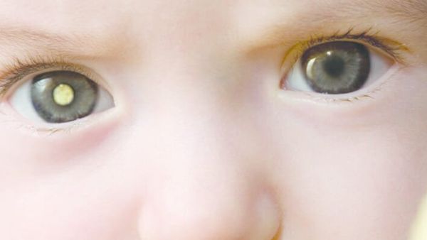 white-Eye In Photo mean white-Eye In Photo mean