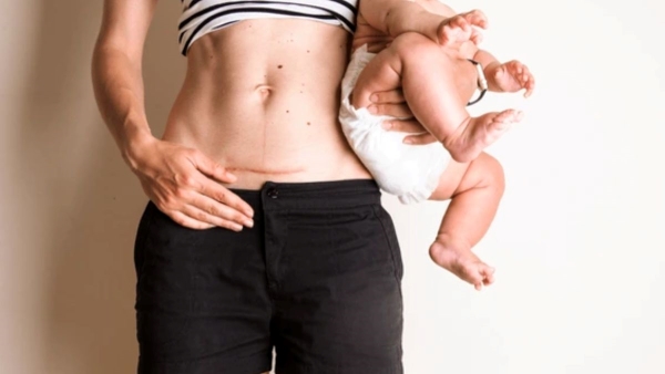 reduce the risk of infection after a C-section