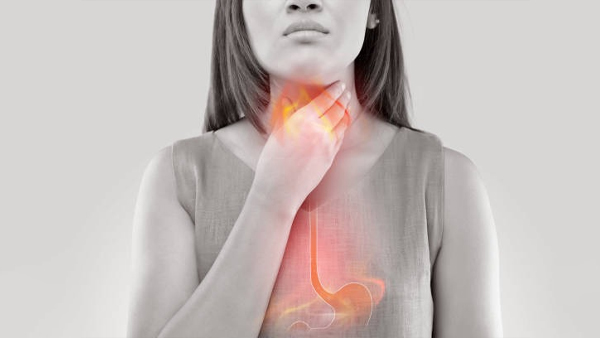 Gastroesophageal Reflux Disease