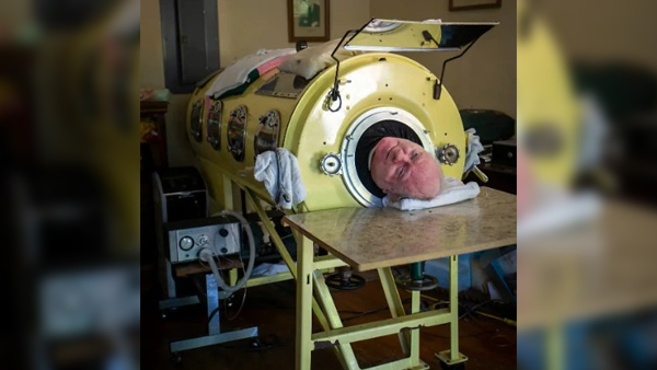 Iron Lung As Paul Alexander Died After 70 Years Iron Lung As Paul Alexander Died After 70 Years