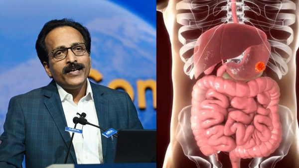 ISRO Chief diagnosed with stomach cancer